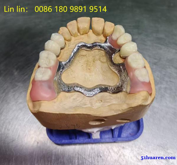 奥克兰专业牙科诊所义齿供应商Myy国际出口合作 义齿厂家 奥克兰专业牙科诊所义齿供应商Myy国际出口合作 义齿厂家