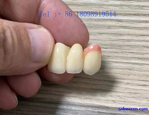 奥克兰专业牙科诊所义齿供应商Myy国际出口合作 义齿厂家 奥克兰专业牙科诊所义齿供应商Myy国际出口合作 义齿厂家