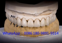 深圳3D打印义齿国际外贸出口厂家