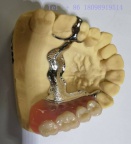 深圳假牙加工厂外贸出口义齿产品