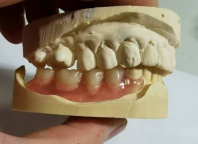 深圳现代化义齿工厂，全产业链优势，承接大批量全口/半口义齿切