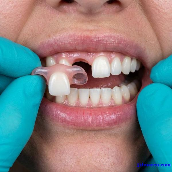 深圳义齿加工厂,专注于数字化义齿设计、切削和外贸出口 深圳义齿加工厂,专注于数字化义齿设计、切削和外贸出口