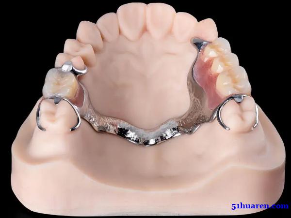 深圳义齿加工厂,专注于数字化义齿设计、切削和外贸出口 深圳义齿加工厂,专注于数字化义齿设计、切削和外贸出口