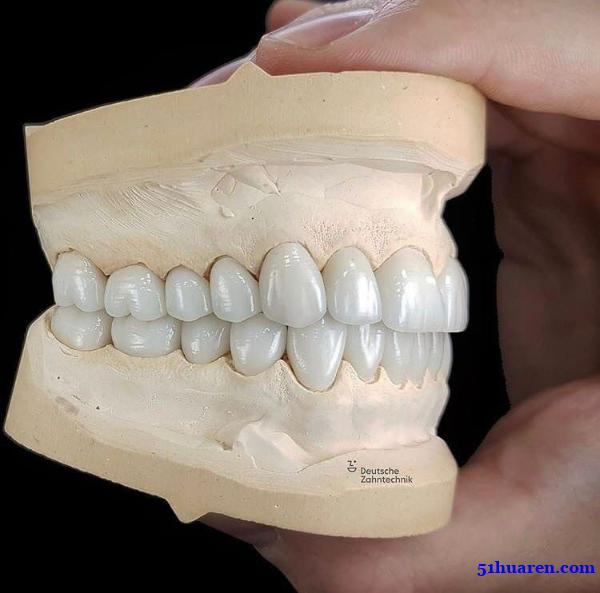 深圳义齿加工厂,专注于数字化义齿设计、切削和外贸出口 深圳义齿加工厂,专注于数字化义齿设计、切削和外贸出口