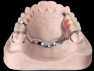 深圳义齿加工厂,专注于数字化义齿设计、切削和外贸出口